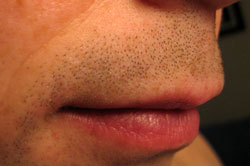 My moustache-in-waiting